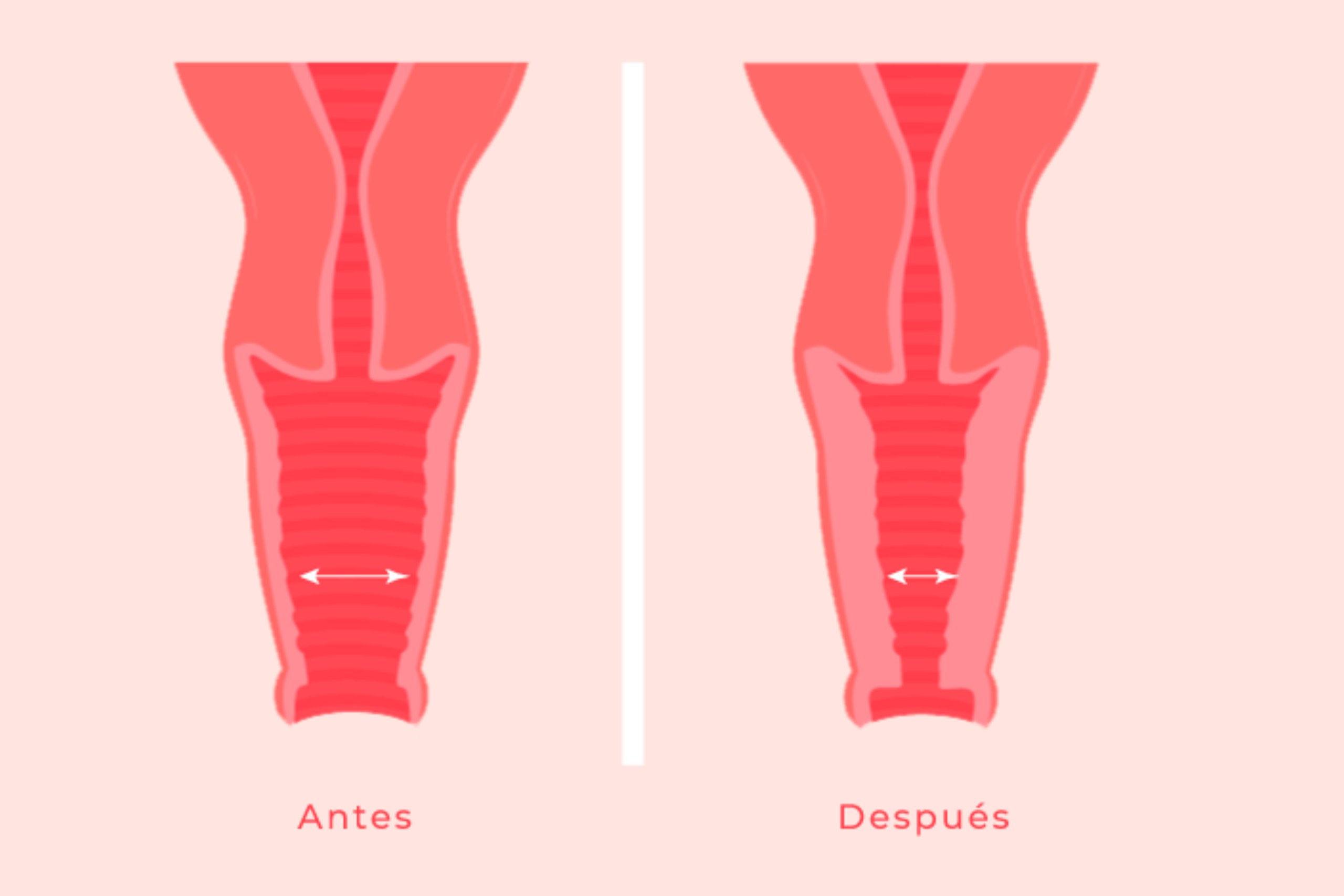 Find Vaginal Rejuvenation Treatment in Pune