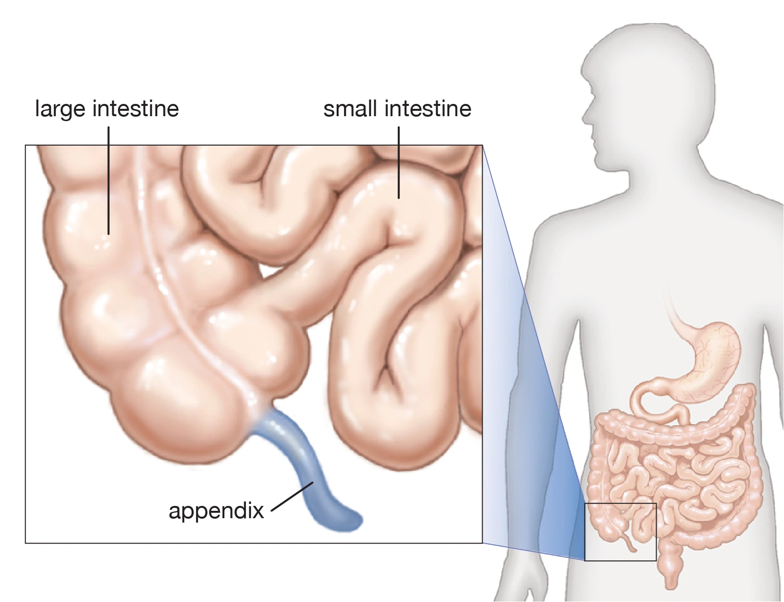 Find Appendix Removal Surgeon in Pune